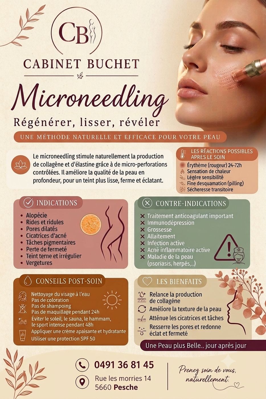 Le microneedling au Cabinet Buchet - Infirmière à Couvin, Marie Buchet